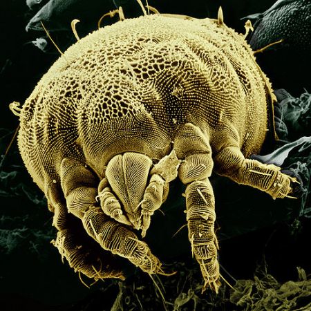 Microorganismele, cauza multor boli
